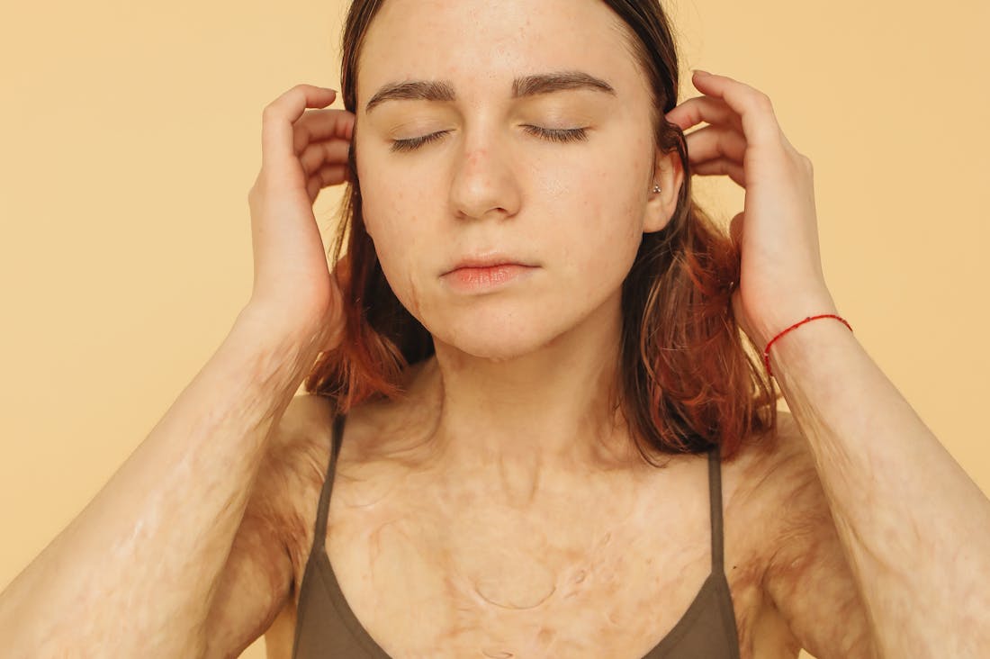 Boosting Mental Wellbeing: Practical Tips for a Healthier Mindset Image 1