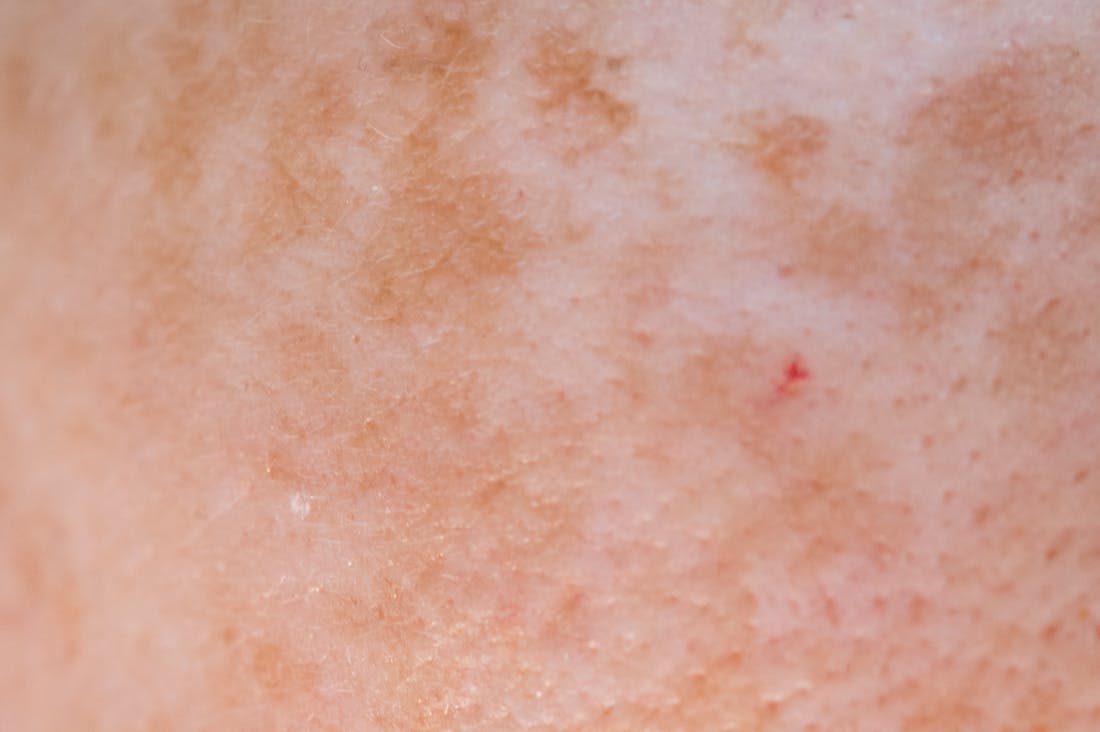 Exploring the Healing Power of Nature: How Outdoor Activities Enhance Mental Health and Wellness Image 1