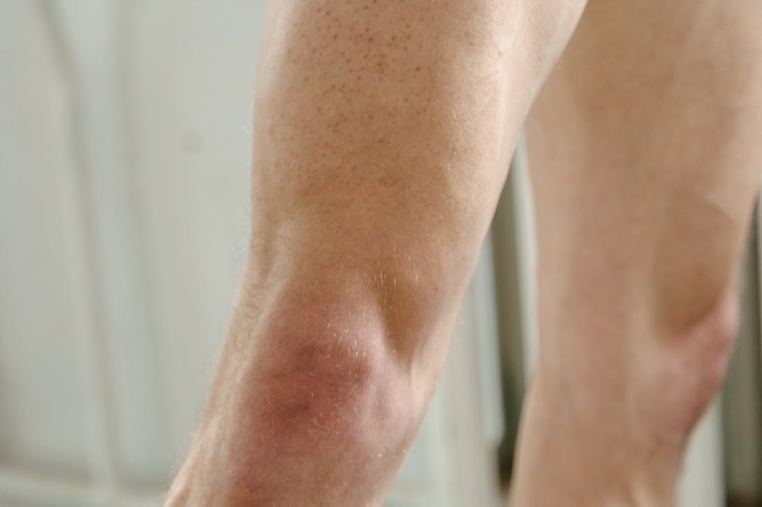 Wanderlust and Wellness: The Benefits of Travel on Mental Health Image 3