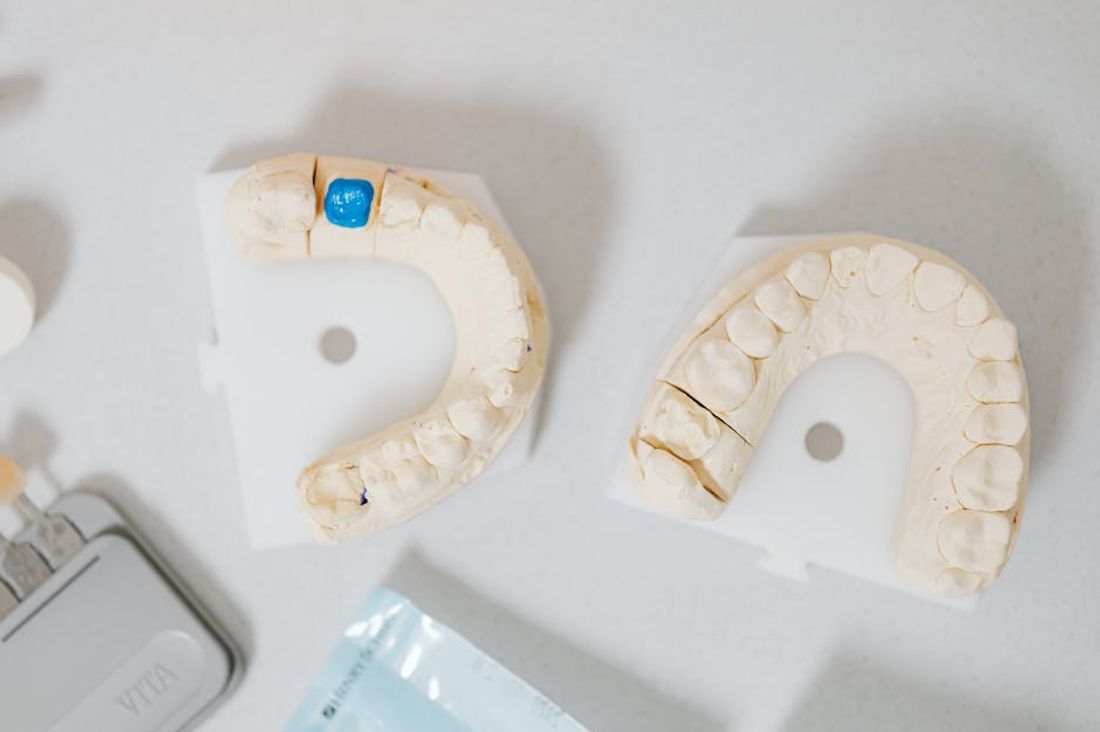 Types of Dental Implants