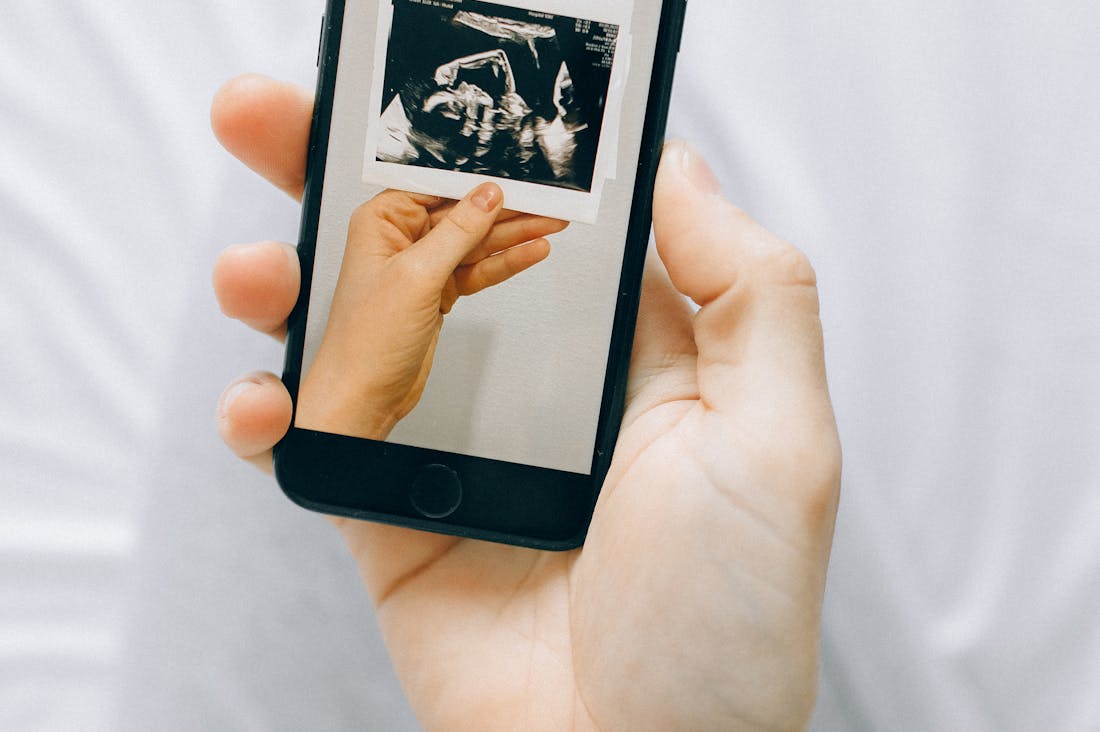 Exploring the Intersection of Health and Tech: How Wearable Devices Are Transforming Our Well-Being Image 3